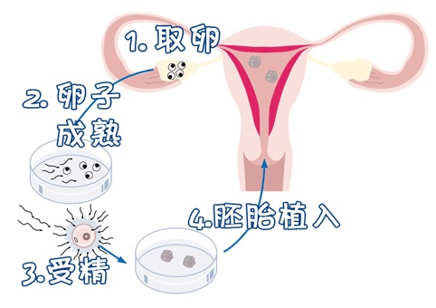 胚胎培养